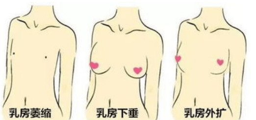 原来70%的女生都有胸外扩，4 招助你重塑傲人曲线！