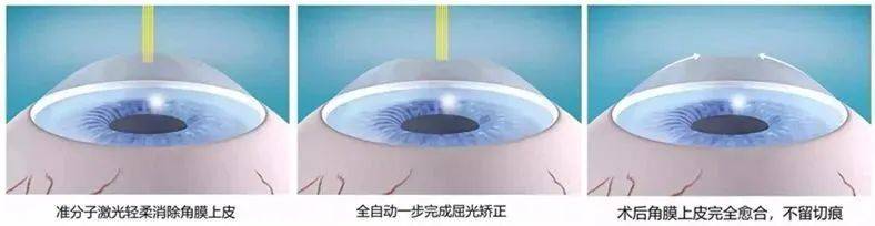 徐州近视眼科医院?排行榜top10公开一览2025年~