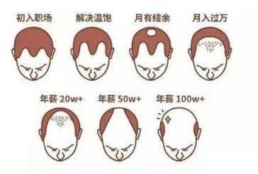 防脱洗发水哪种效果好？效果显著的几款！