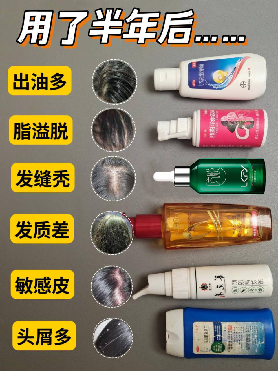 生发产品哪个效果最好？深受追捧