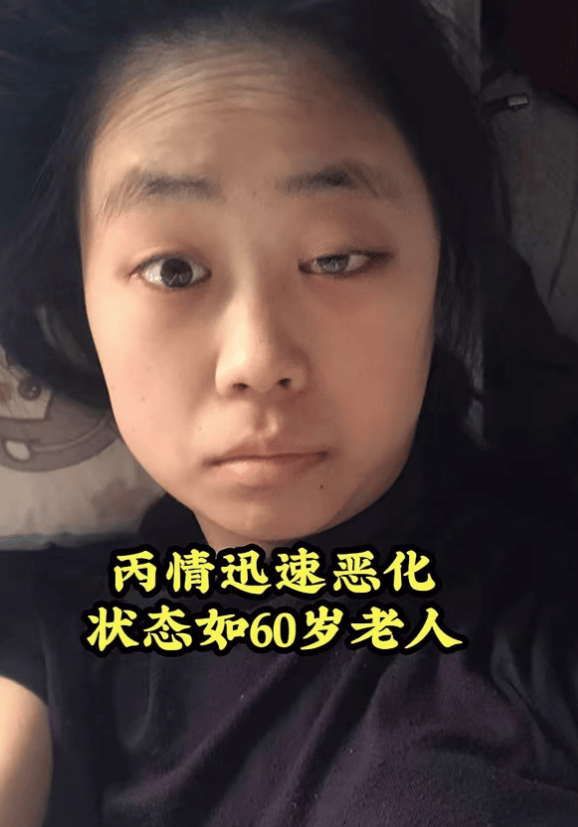 山东美女梦圆去世，年仅19岁，生病前后容貌大变，上月拍好了遗照