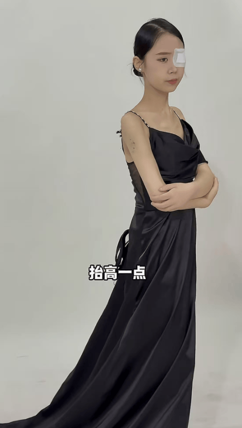 山东美女梦圆去世，年仅19岁，生病前后容貌大变，上月拍好了遗照