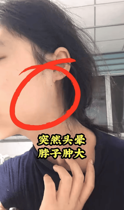 山东美女梦圆去世，年仅19岁，生病前后容貌大变，上月拍好了遗照