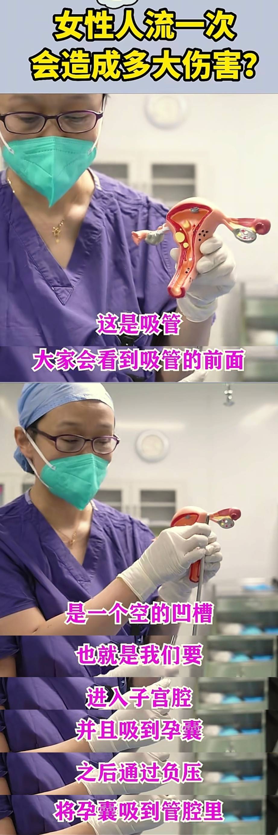 医生用流产器械给子宫模型进行流产,告诉女人:人流有多伤身