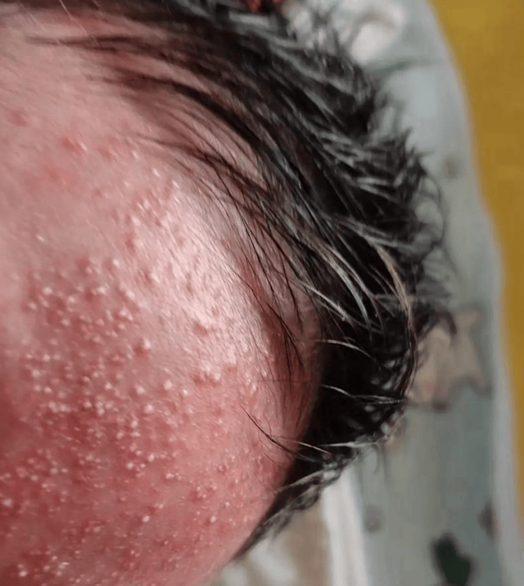 这些很多孕妇都喜欢吃的食物,却会引发胎毒,孕期要少吃