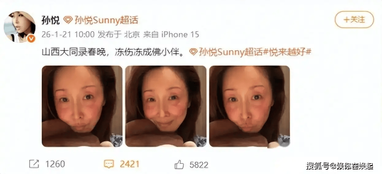 春晚录制出现事故！知名女歌手面部已毁，让人担心的事情发生了