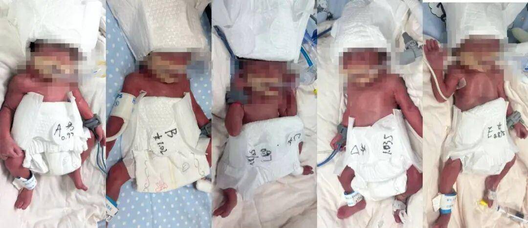 妈妈早产生五胞胎体重相加不到十斤,医生:罕见又危险!为啥现在多胞胎这么