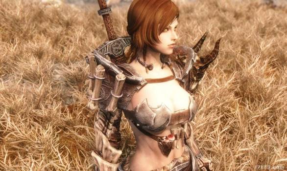 17岁女孩团建时遇车祸昏迷4个月