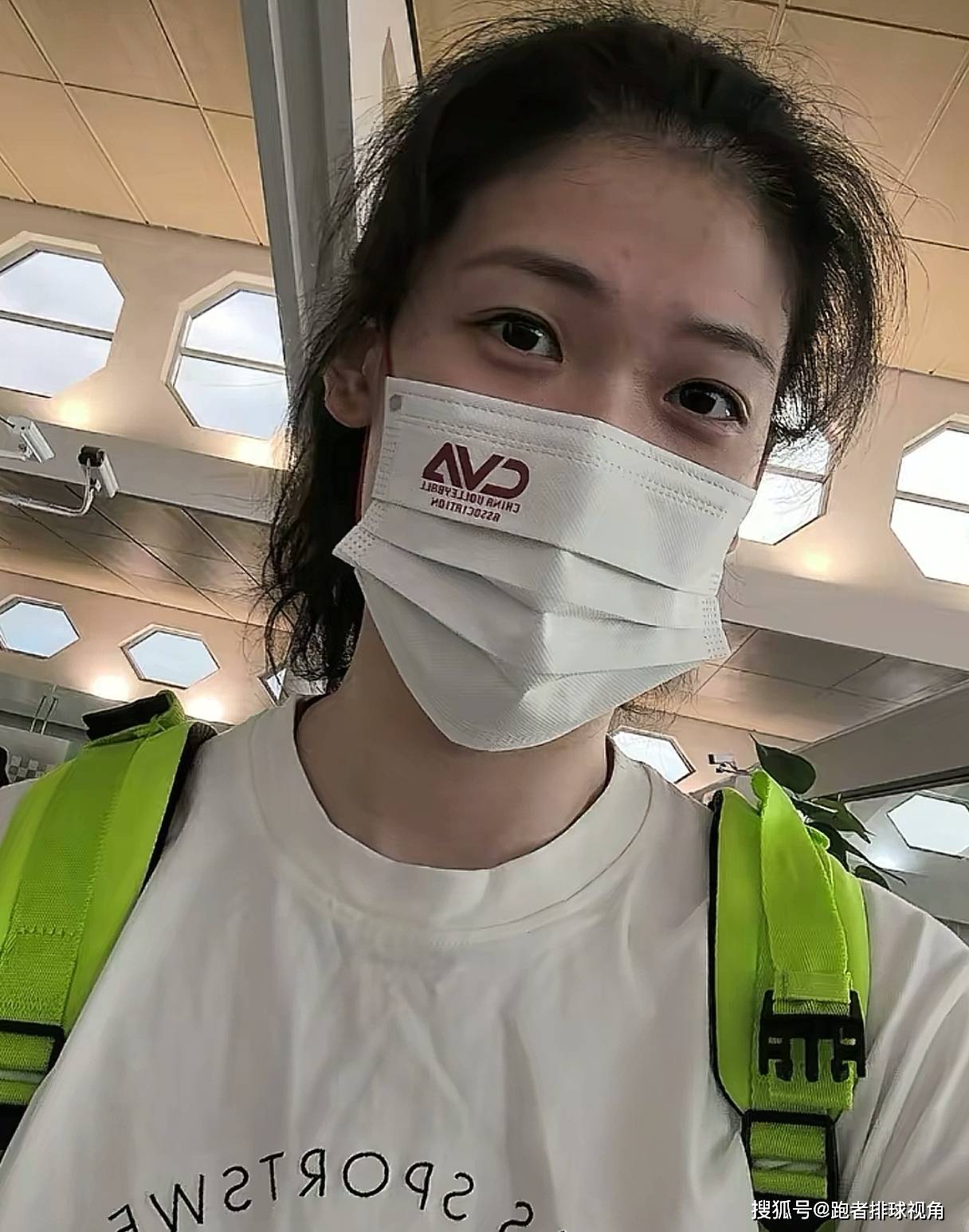 原创             李盈莹发布康复过程！手术照首次公开，白头发抢眼，状态已超预期