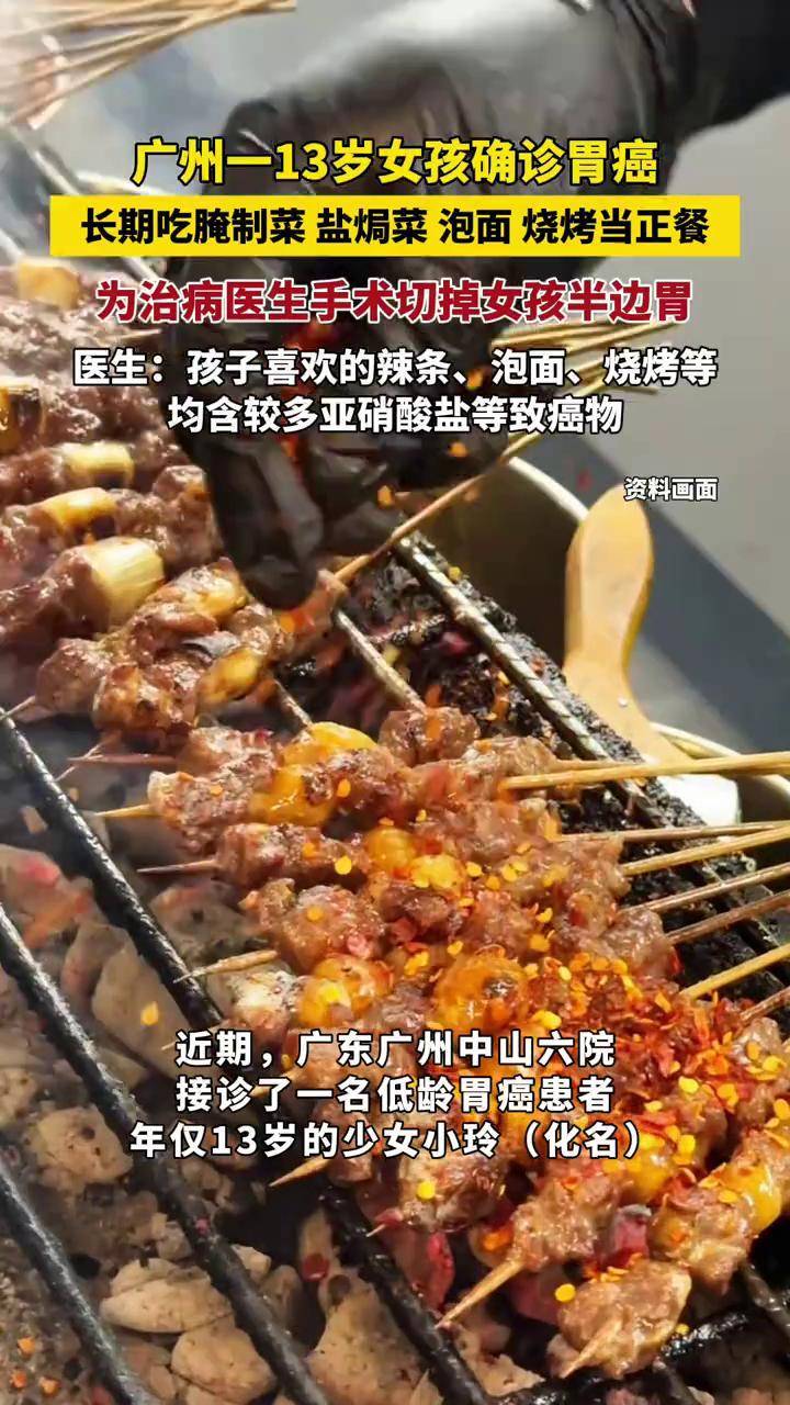 13岁女孩查出胃癌！医生提醒：这些饮食习惯要当心 来源：光明网