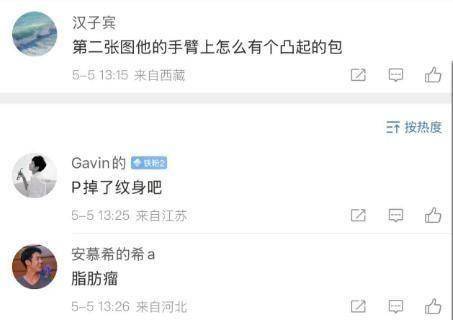 赵薇与好友聚会照流出，素颜出镜发福严重，手臂上长了一个大包
