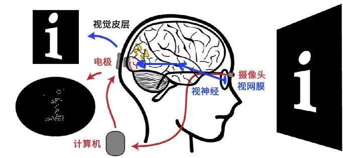 一个意外，脑机接口试验让盲人恢复了视力
