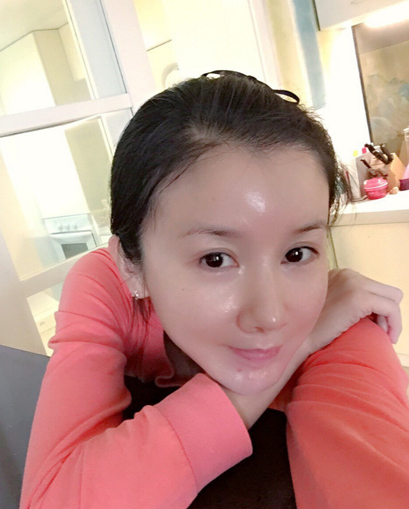 孙菲菲:曾经热衷于整容,被医美坑惨的她,现在终于明白了!