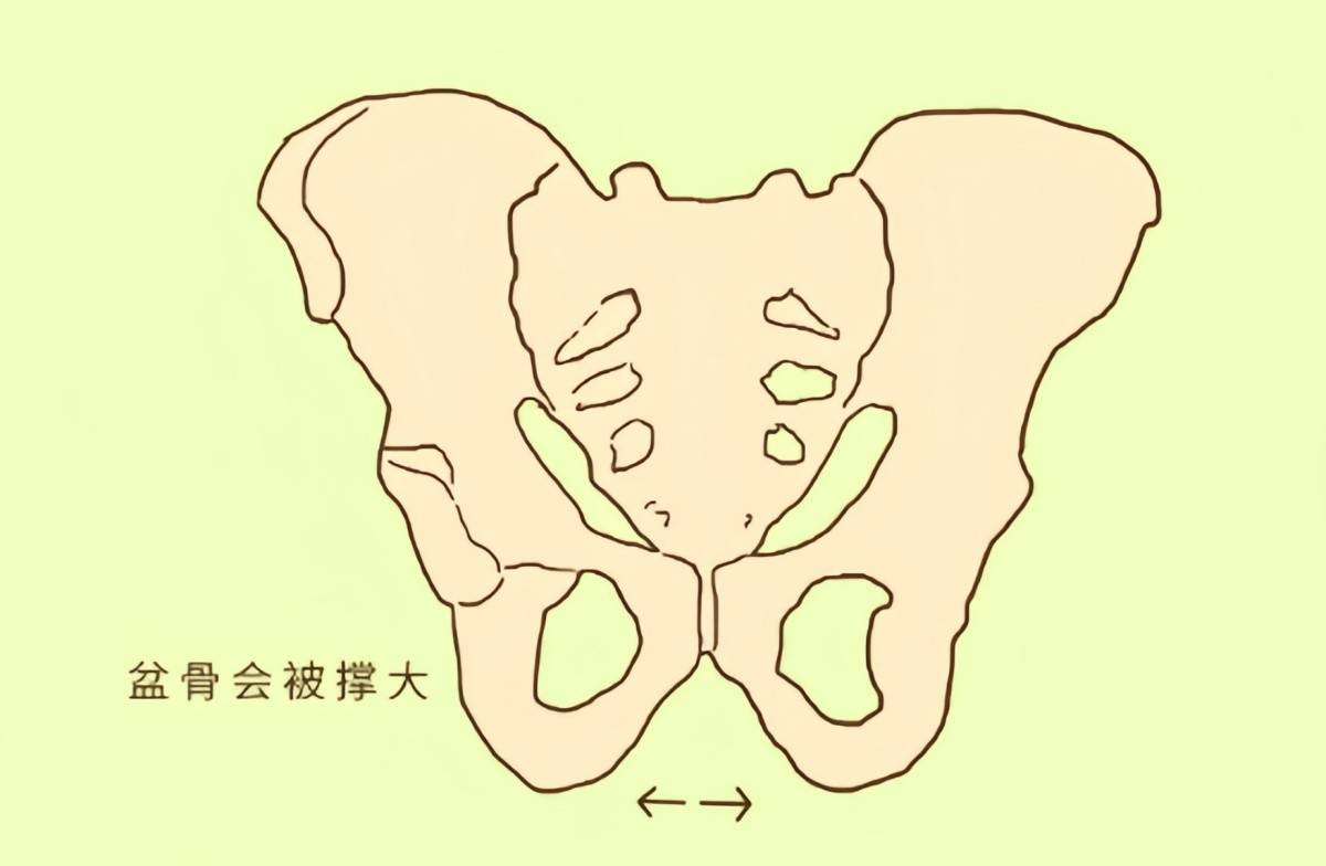 “妇女胯”和“少女胯”有啥区别？怎样才能重回少女胯？