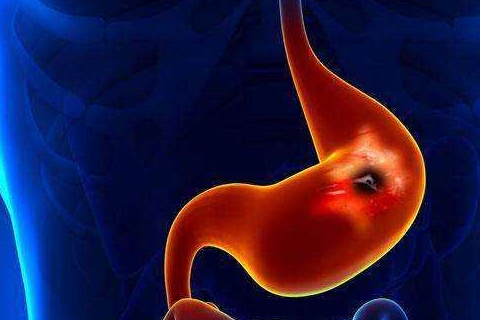 平时多吃3物,胃会慢慢的变好_胃部_食物_进行