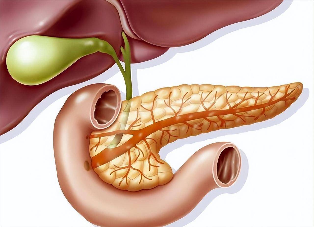 兩種胰腺炎,治療方法不一樣!提前做好預防,別等嚴重再