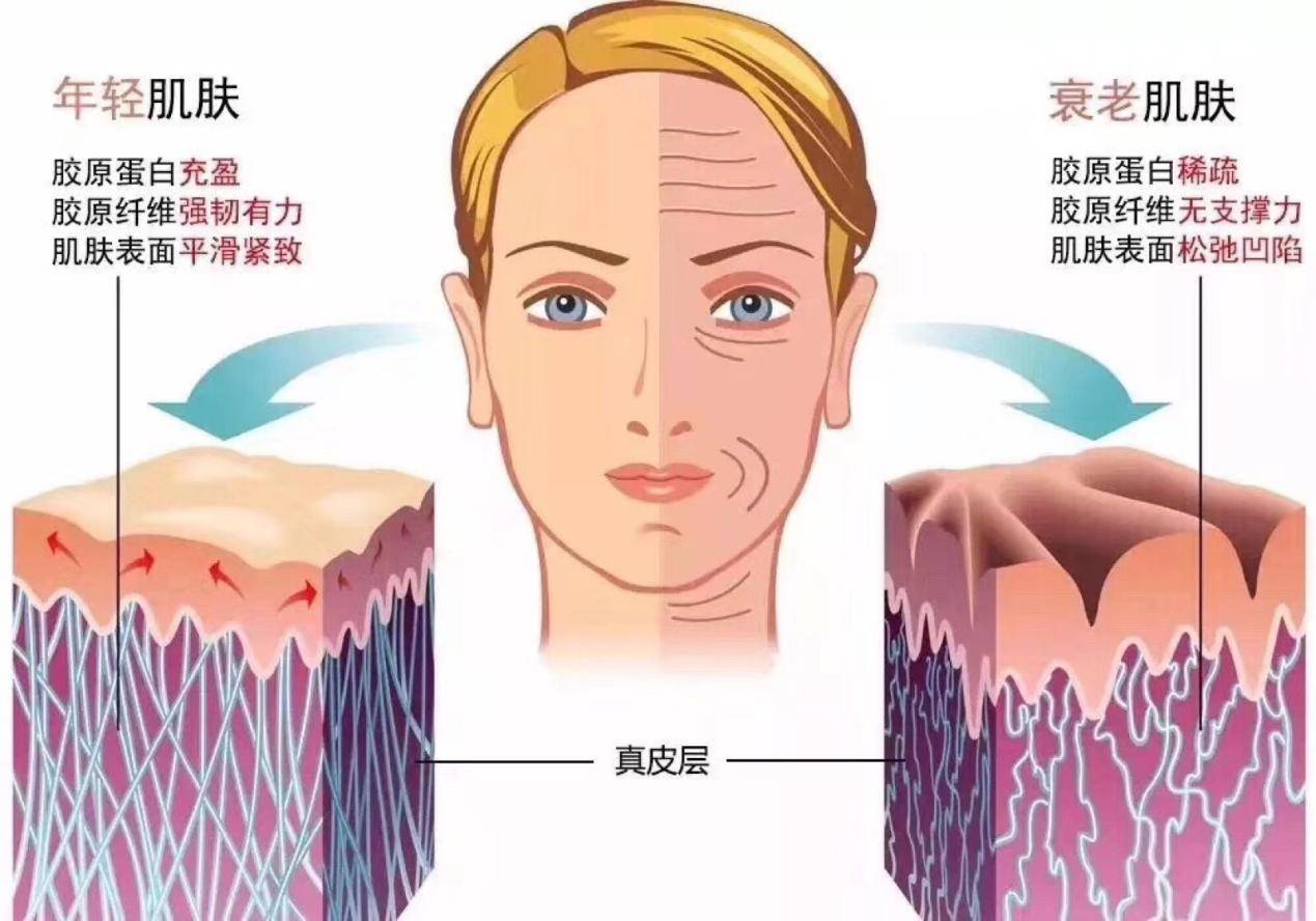 皮肤衰老过程示意图图片