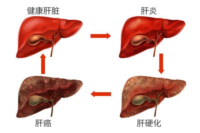 猪胆在肝的位置图片图片