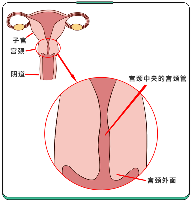 宫颈糜烂需不需要做手术？