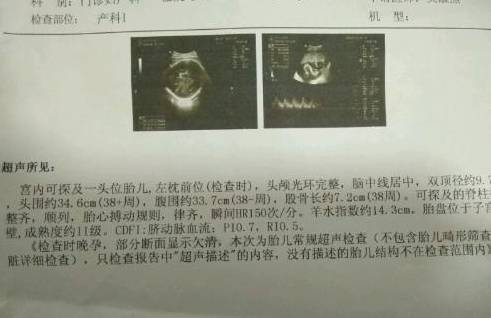 孕15周女孩b超生殖图片图片