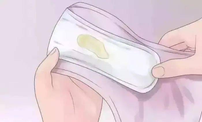 宫颈炎会癌变吗有hpv阴性_风险_问题_炎症