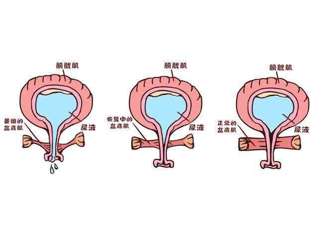 醫生道出大