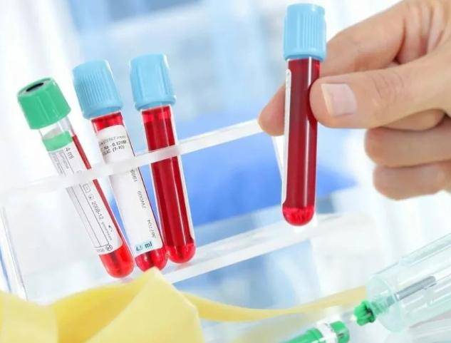 提醒:o型血的人或有4个缺点,要多加注意_血型_遗传_生活