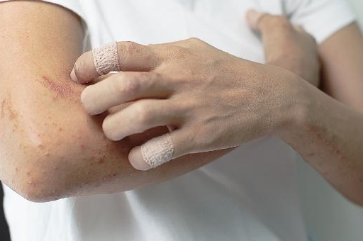 如果身体没有这3种情况,或许说明身体比较健康,梅毒离