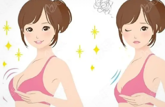 自体脂肪隆胸真实讲述:抽脂丰胸安全吗?内行人告诉你