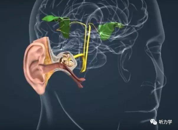 万聪听力连锁提醒您——听力损失如何影响大脑功能?__