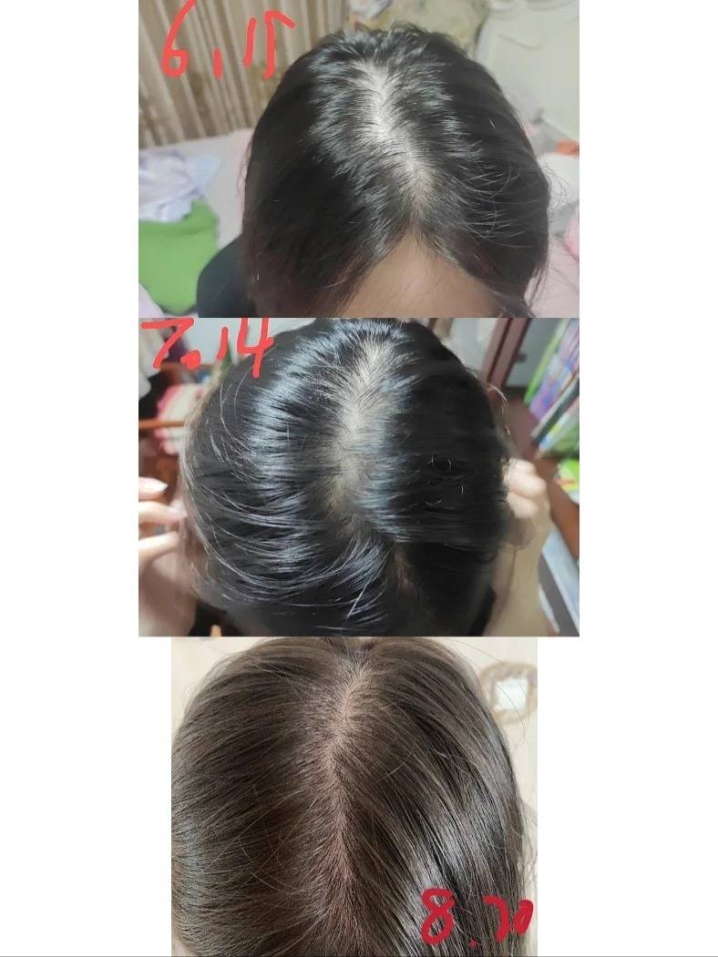 好用到词穷!_头皮_感觉_效果