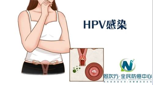 人乳头状瘤病毒(hpv)感染是宫颈癌的主要致病因素之一,恩次方全民防癌