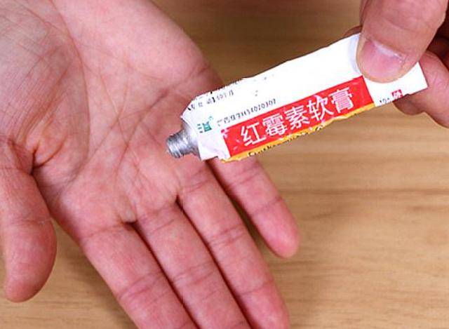 2块钱的红霉素软膏被称为"淡斑专家"?