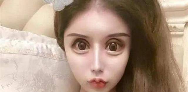 3年整了60次的网红女孩,现状如何?_整形_娜娜_生活