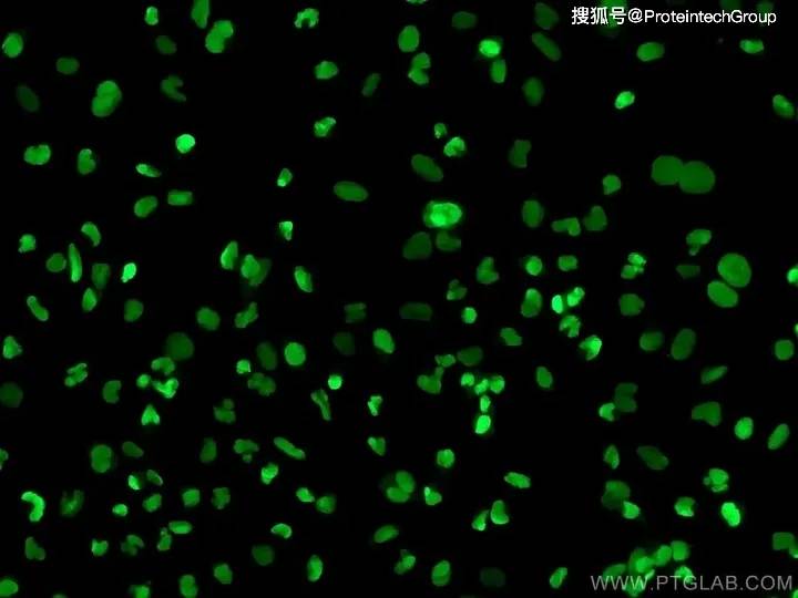 IFA免疫荧光图片