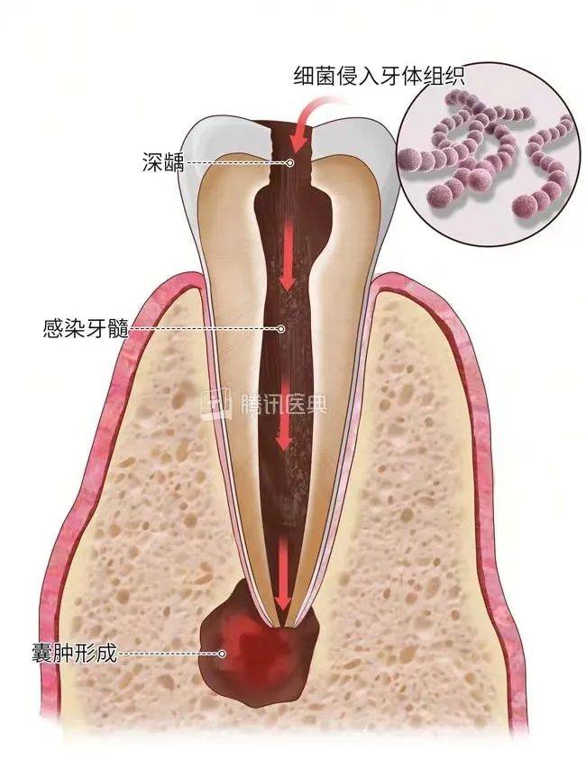 上齿龈根部位置图图片