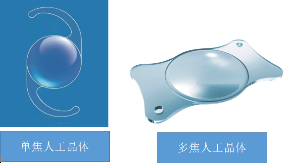 我院成功开展多焦点人工晶体植入术 助患者重现清晰"视"界_手术_治疗