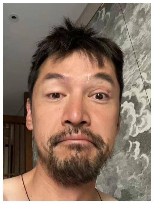 胡歌状态神秘!意外晒照露车祸伤疤,低落悲观引担忧._留言_内心_照片