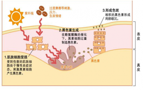 首先,我们需要了解色斑的形成原因.