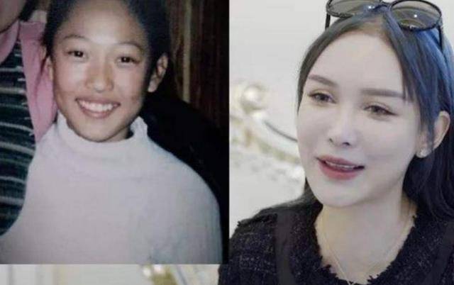 14岁女孩被妈妈拉去整容,前前后后15年花去400万,网友:白瞎了_吴晓辰