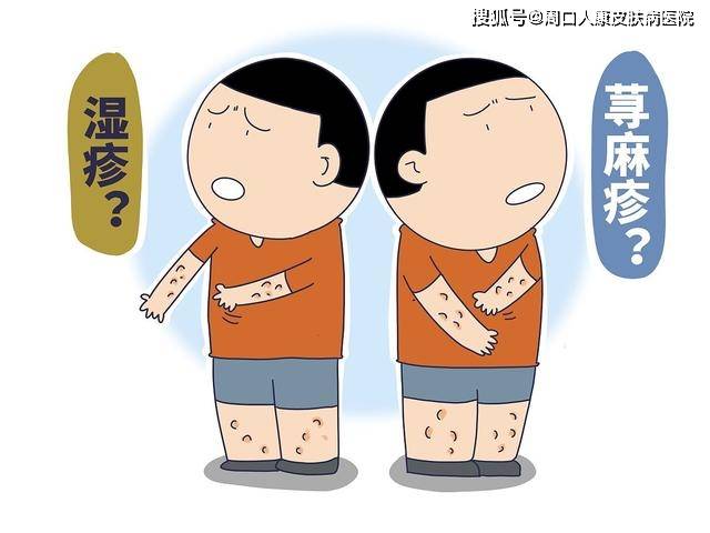 【周口人康皮肤病医院】湿疹和荨麻疹怎么区分?_症状_双胞胎_身体
