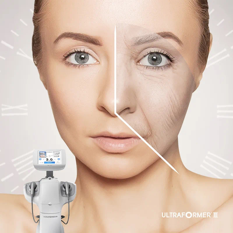 7d聚拉提效果维持多久,7d聚拉提一年做几次最好?_mm_超声波_身体