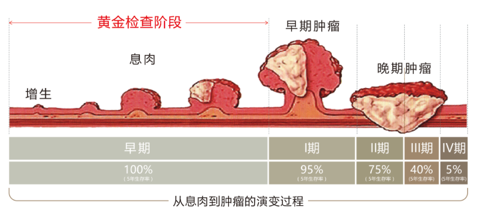 成都博仕胃肠病医院提醒 长这样的息肉一定要重视