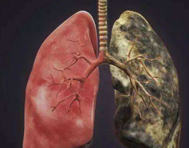 肺部损伤时,身体可能亮3个"红灯",提前知道或许能避免