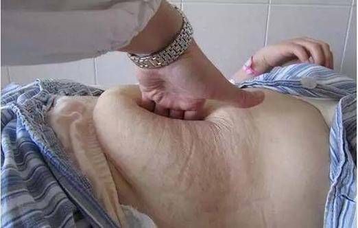 腹部_妈妈_肚子