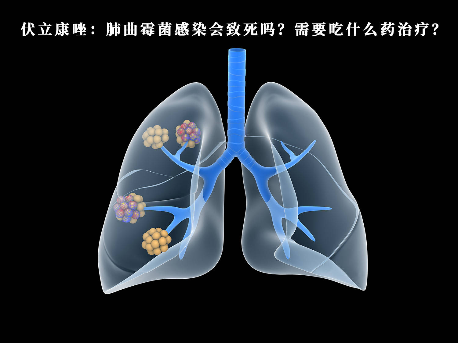 进口伏立康唑注射价格图片