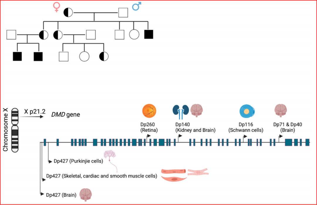 dmd的致病基因为抗肌萎缩蛋白基因,位于染色体xp21.