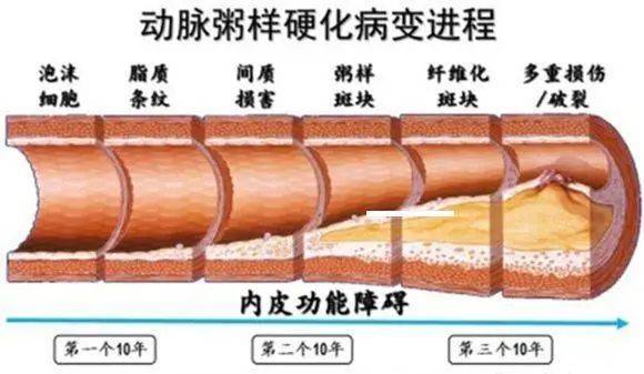 雙迪富氫|《營養學報》:氫分子在肥胖,脂肪肝,糖尿病等代謝疾病的干預