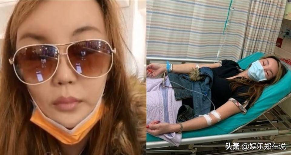 演员高溜整容失败后,张婷婷"脸肿"挂急诊,曾因整容肿成包子脸_法拉利