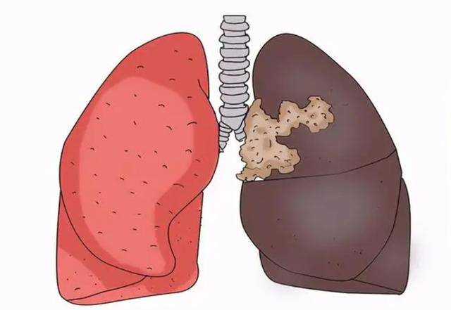 男性一天可以吸多少支烟?